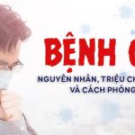 Bệnh cúm: Nguyên nhân, triệu chứng, điều trị và cách phòng ngừa