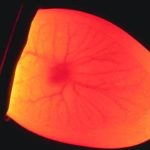 Gà ấp bao nhiêu ngày thì soi trứng, soi trứng để làm gì