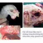 Nguyên nhân, triệu chứng của bệnh ĐẬU GÀ và cách chữa trị từ A-Z